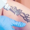 Alquiler mensual Laser tatuajes