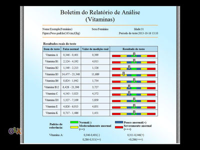 Analizador de ressonância Cuântica - Foto 4