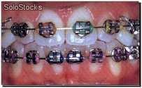 Anillos elastoméricos de colores para ligaduras - Dentalastics &quot;Personal&quot;