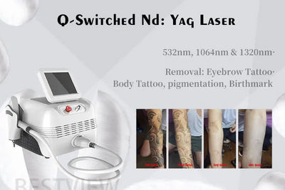 Beauty Equipment Q-Switched ND YAG Máquina de eliminación de tatuajes con láser - Foto 4