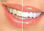 Blanqueamiento de diente, dental, lampara dentista , blanqueador laser - Foto 3