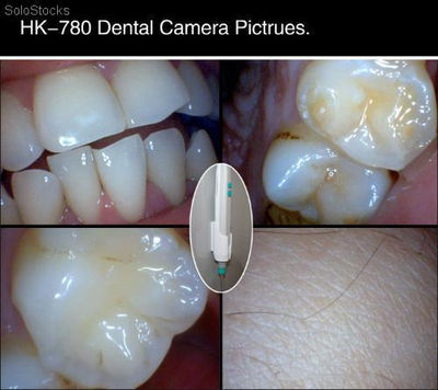 Cámara Intraoral Dental usb 6 led xp/Win 7/Vista desde la fabrica China! - Foto 4