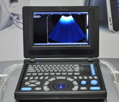 Canyearn A10 Full Digital Laptop Ultrasonic Diagnostic System - Photo 3