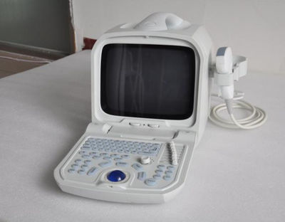 Canyearn A60 Full Digital Portable Ultrasonic Diagnostic System - Photo 3