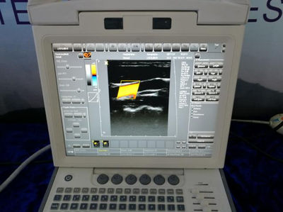 Canyearn C10 Full Digital Portable Ultrasonic Diagnostic System Color Doppler Ul