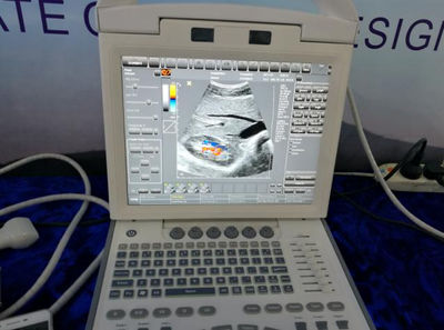 Canyearn C10 Full Digital Portable Ultrasonic Diagnostic System Color Doppler Ul - Photo 5