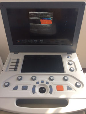 Canyearn C95 Full Digital Portable Ultrasonic Diagnostic System Color Doppler Ul - Photo 4