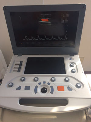 Canyearn C95 Full Digital Portable Ultrasonic Diagnostic System Color Doppler Ul - Photo 5