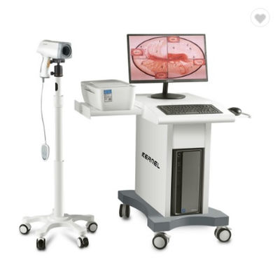 CE&amp;FDA Digital Colposcopio Sony Cámara Para Examinación Ginecológica
