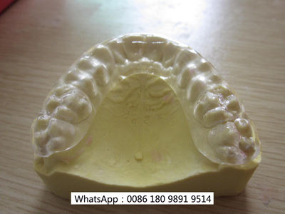 Chinese Dental Lab, China Dental Lab, Chinese Outsourcing