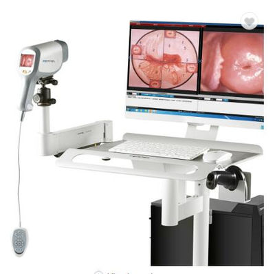 Colposcopio Digital para Examen Ginecológico Vagina Vulva HD Cámara - Foto 2