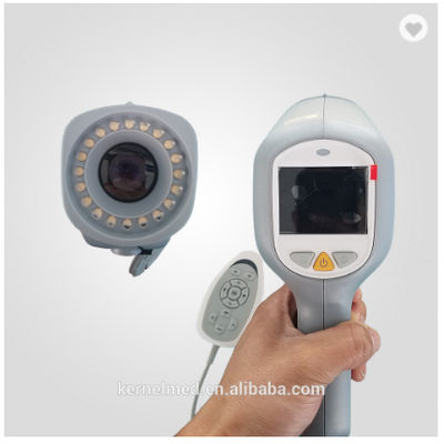 Colposcopio Digital para Examen Ginecológico Vagina Vulva HD Cámara - Foto 3
