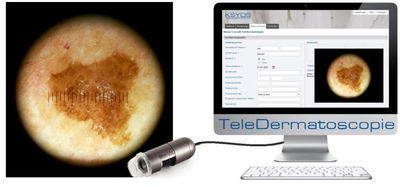 Dermatoscopio DermaScope MEDL4DW Dino-Lite