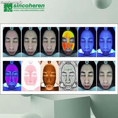 Dermo Analizador facial Derma escáner espejo mágico inteligente - Foto 3