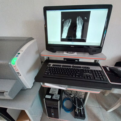 Digitalizador rayos x - Foto 4