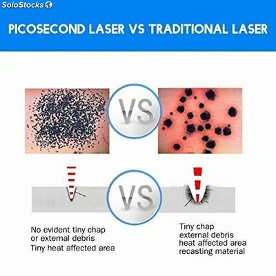 Disoleatore a punta laser per rimuovere verruche tatuaggi talpe lentiggini - Foto 5