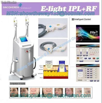 e-Light (smq-eb) depilacion y rejuvenecimiento, ipl + rf,e-luz