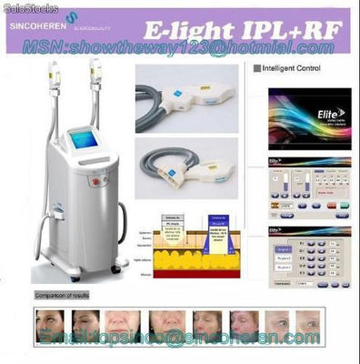 e-Light (smq-eb) depilacion y rejuvenecimiento, ipl + rf,e-luz - Foto 2