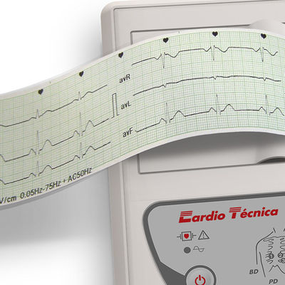 Electrocardiografo 3 Canales Cardiotecnica RG501Plus - Foto 2