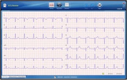 Electrocardiografo digital CV1200 con interpretacion - Foto 3