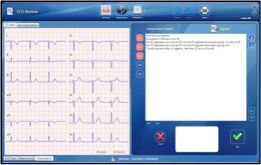Electrocardiografo digital CV1200 con interpretacion - Foto 5