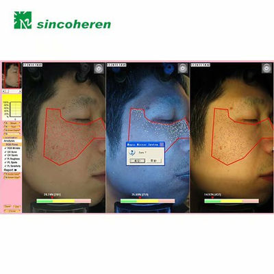 Equipo Analisis facial para cara - Foto 3