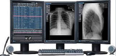 Equipos y suministros Radiologicos - Foto 3