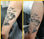 Estacionário Nd Yag Laser máquina de remoção de tatuagem com preço de fábrica - Foto 5
