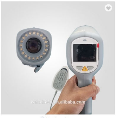 Full HD Video Digital Colposcope for Gynecology - Foto 3