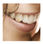 Kit de pose professionnelle de Bijoux dentaires - Photo 3