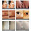 Lápiz para quitar manchas de la piel con terapia de luz azul - Foto 3