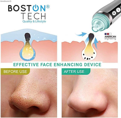 Limpiador Facial Poros Removedor de puntos negros Ultima Tecnología - Foto 3