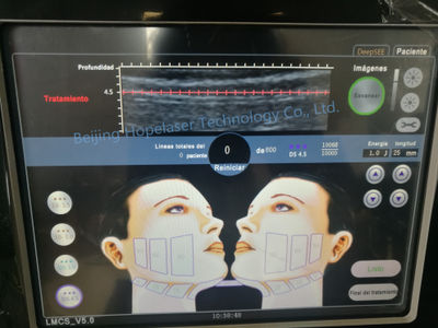 Máquina belleza HIFU eliminación arrugas elevación facial equipo HIFU - Foto 4