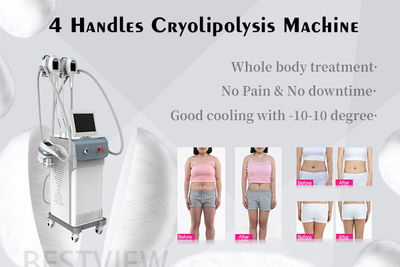 Máquina de adelgazamiento corporal de reducción de grasa por criolipólisis