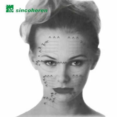 microdermabrasion facial - Foto 3