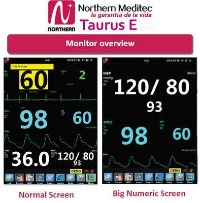 Monitor de Signos Vitales Marca Northern Meditec Modelo TAURUS E Basic - Foto 3