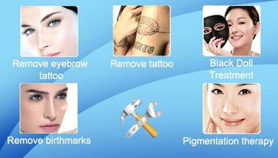Nd yag q-switched eliminación de tatuajes Eliminar la pigmentación - Foto 3