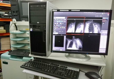 Numériseur radiologie mammographie d&amp;#39;occasion FUJI - Photo 4