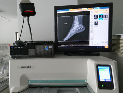Numériseur radiologie mammographie d&amp;#39;occasion PHILIPS - Photo 3