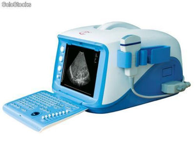 ob / gy portátiles escáner de ultrasonido
