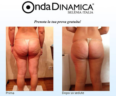 Ondadinamica - Photo 4