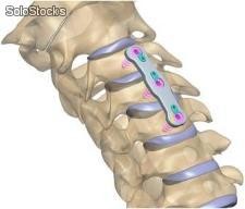 Foto del Producto Prótesis de columna Precision Spinal