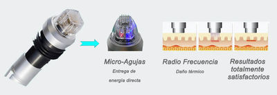 Radiofrecuencia fraccionada con micro aguja - Foto 2