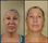 Radiofrecuencia rejuvenecimiento anti-arrugas cosmetica belleza - Foto 2