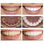 Removedor De Placa Y Blanqueador Dental Instantaneo - Foto 2