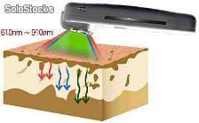 Skin Care Laser Fotoodmładzanie Odmładzanie skóry Laser lllt Zdrowa skóra - Zdjęcie 3