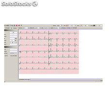 Software Bionet EKG-Plus