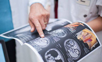 Système impression papier A3 livrest, A4 pour radiologie Scanner IRM Echographie - Photo 2