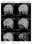 Système impression papier A3 livrest, A4 pour radiologie Scanner IRM Echographie - Photo 4