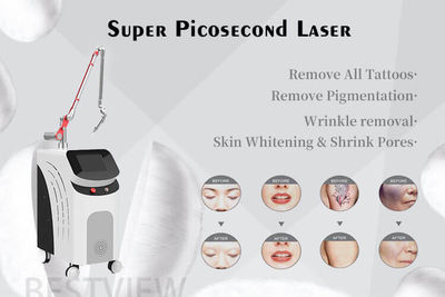 Tattoo Removal Machine Super Picosecond Laser Beauty Equipment - Foto 2